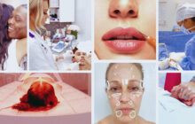 Skin Decision: Before and After izle